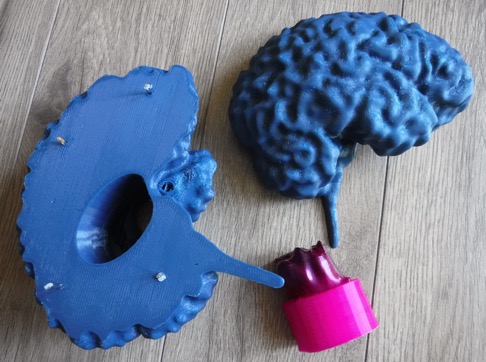 MRI Brain — miniatura 2