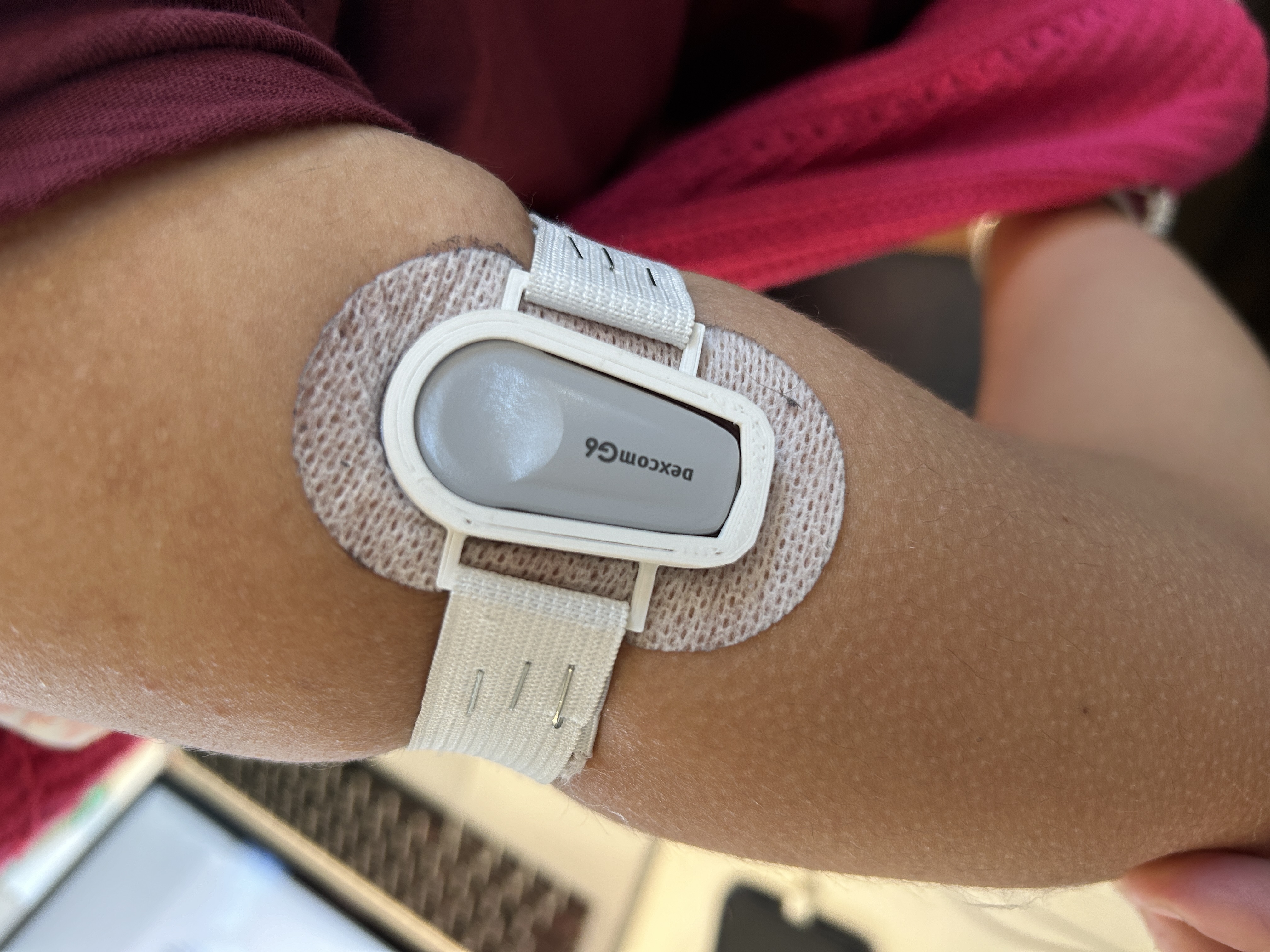 Dexcom G6 sport sensor support