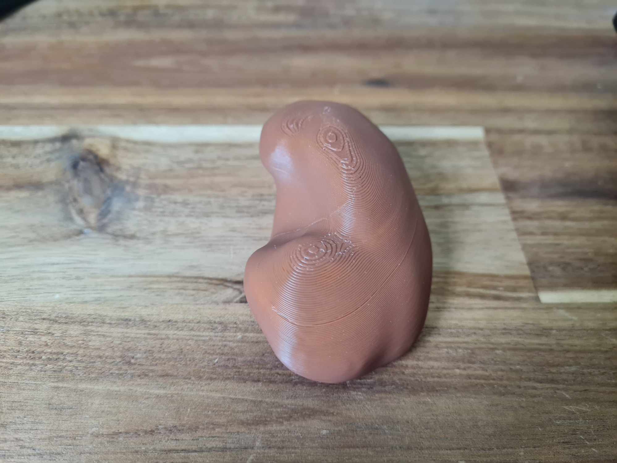 Human kidney