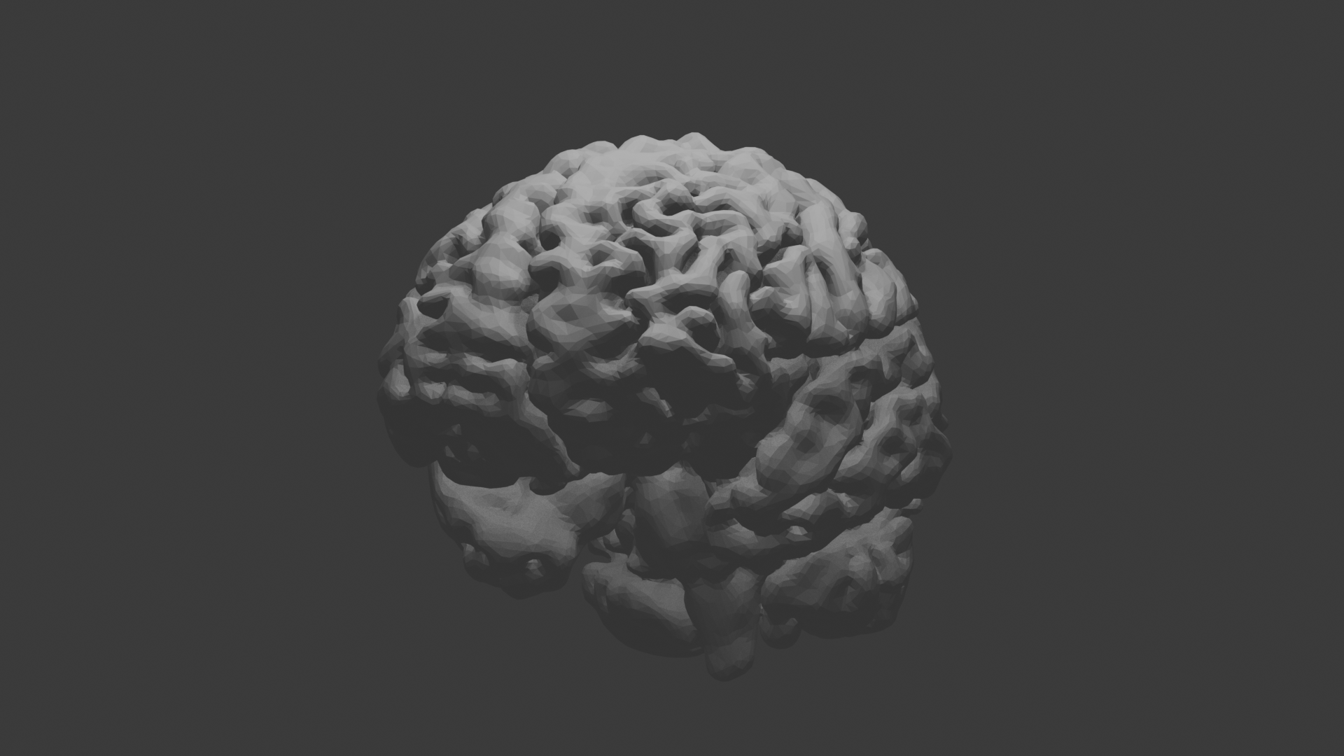 Brain MRI