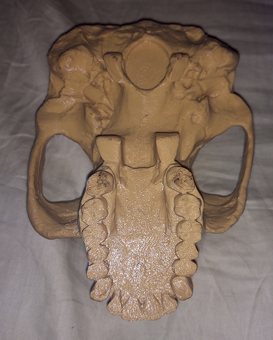 Australopithecus