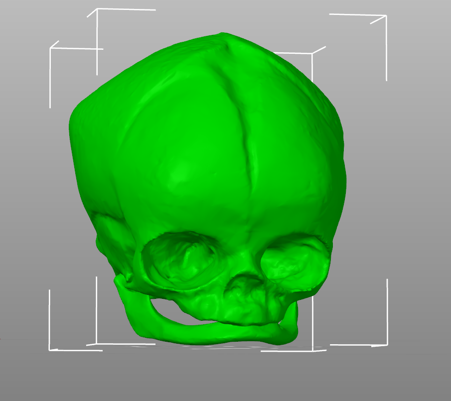 Newborn Baby Skull by Skeleton Dan | Download free STL model ...