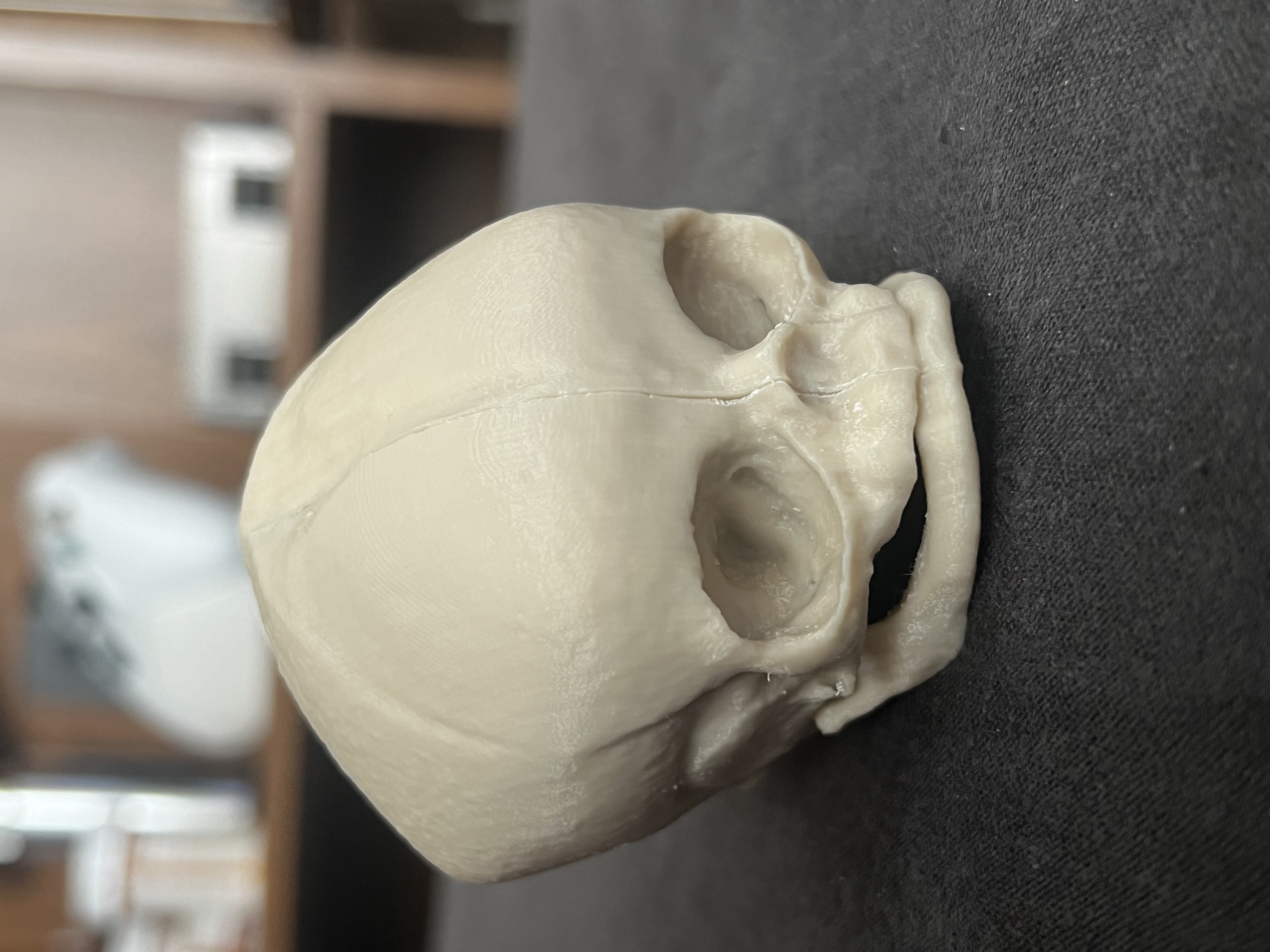 Newborn Baby Skull