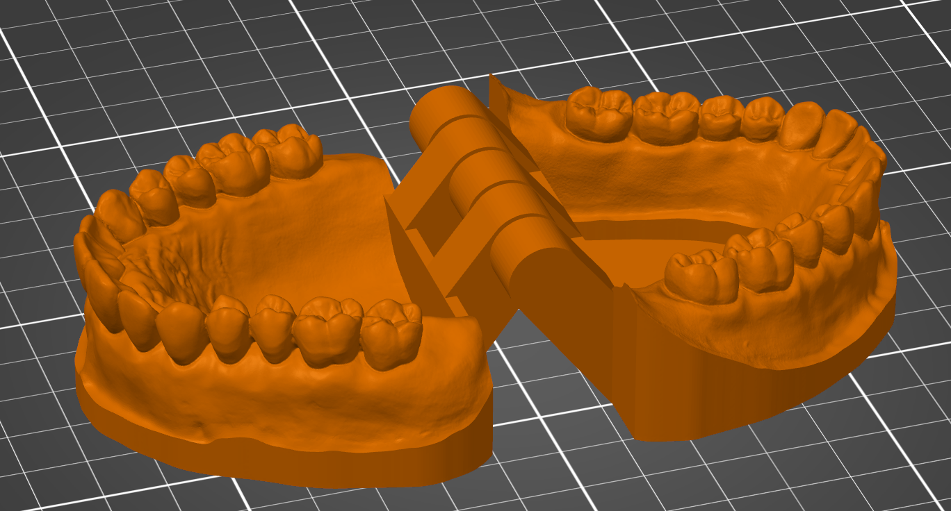 Realistic denture model with a print-in-place hinge