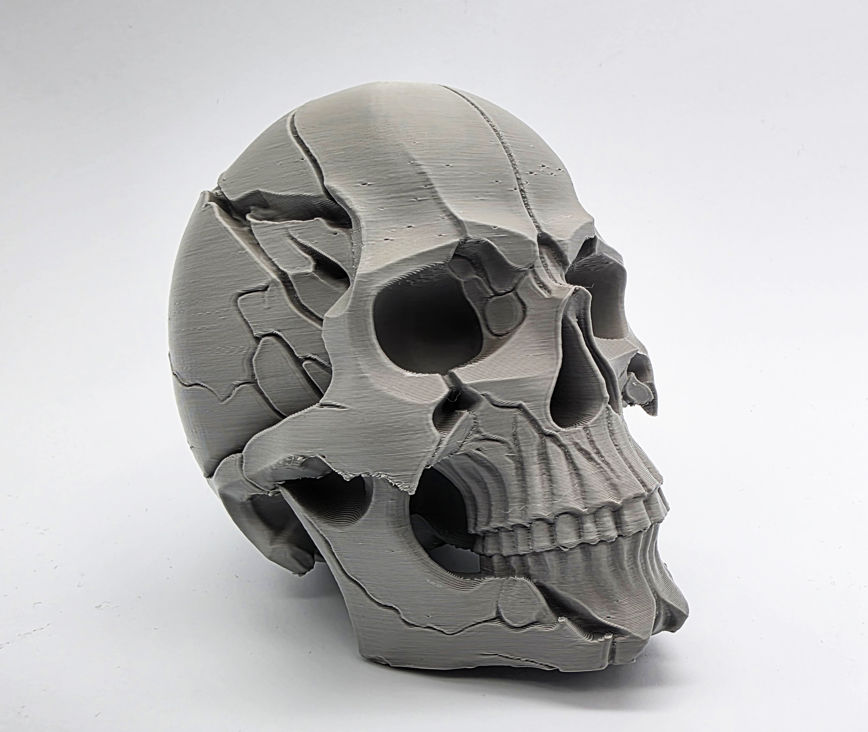 Cracked Human Skull