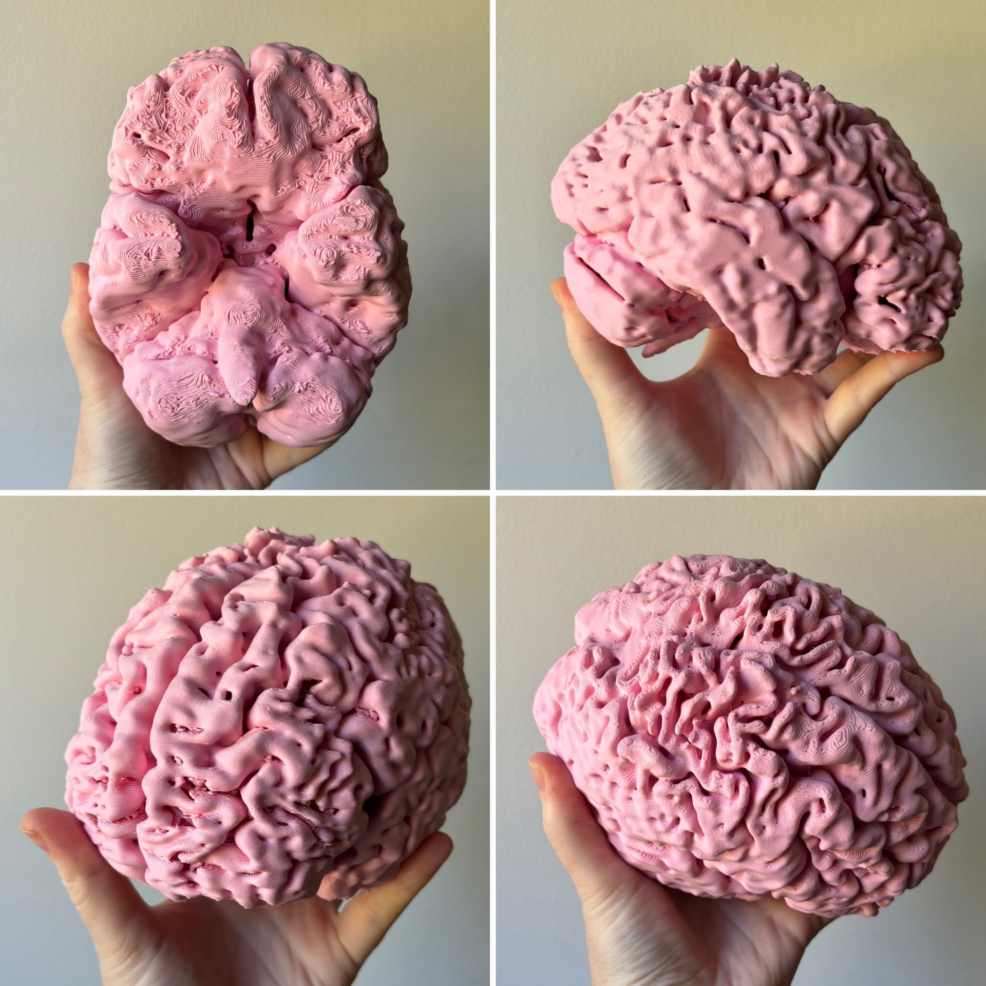 My Genuine Human Brain