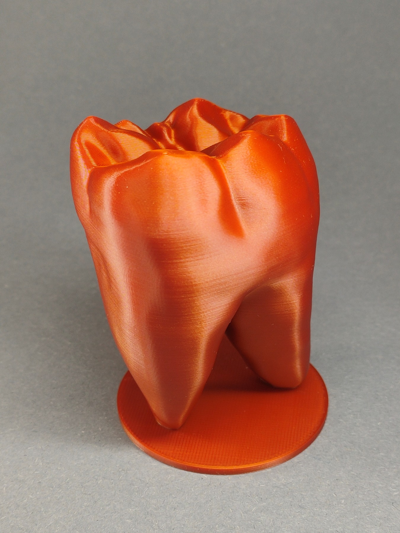 Lower Molar study model 3D model