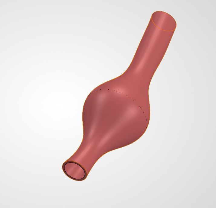 Fusiform aneurysm
