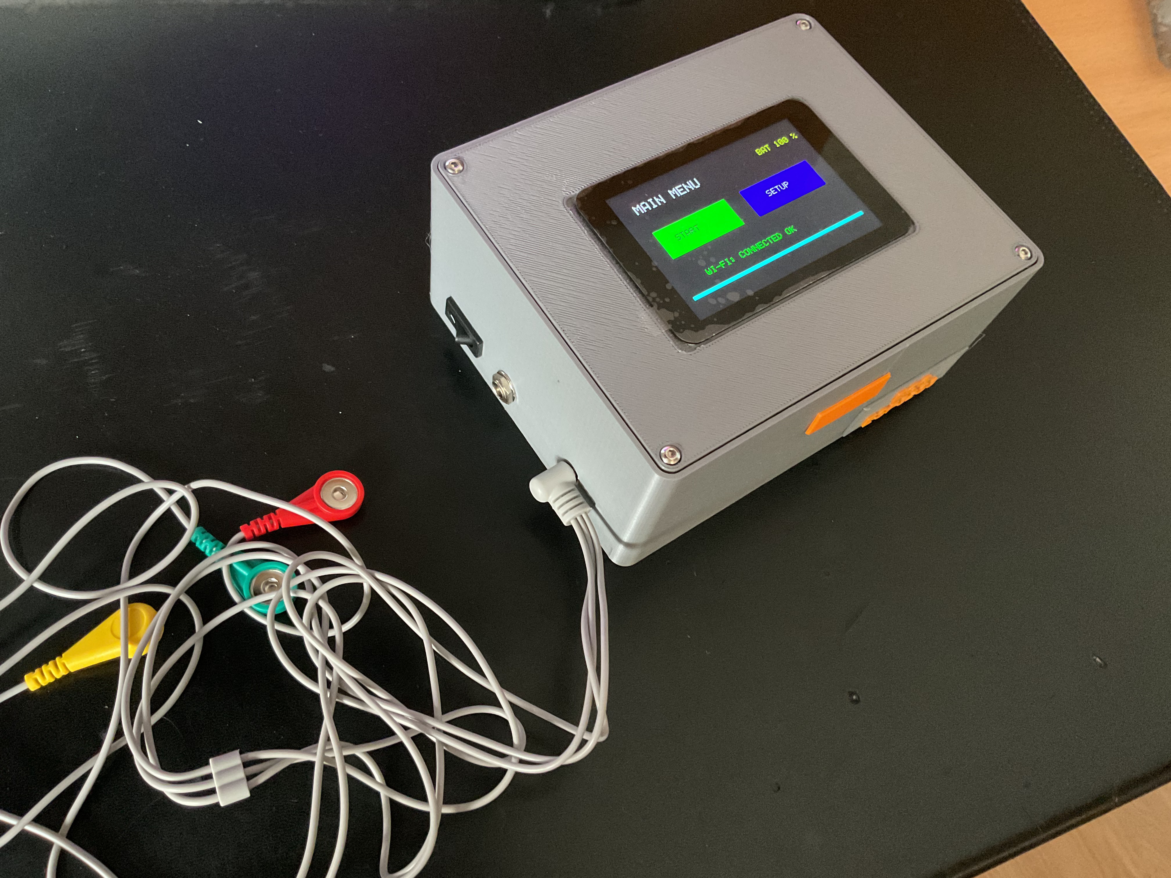 ECG Monitoring system with email and PC output