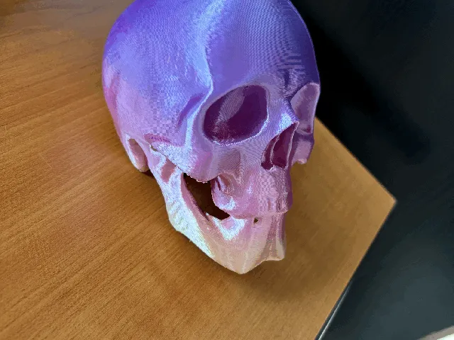 Skull