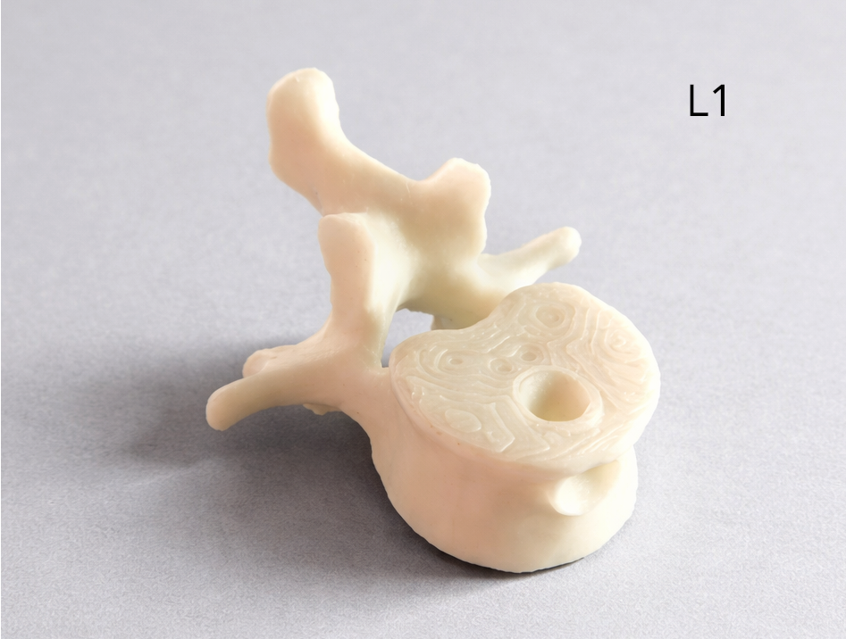 Lumbar Vertebra (L1) Keychain – Anatomy Model | Medical Student / PT / Chiropractor Gift