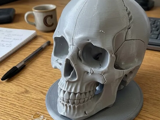cranium