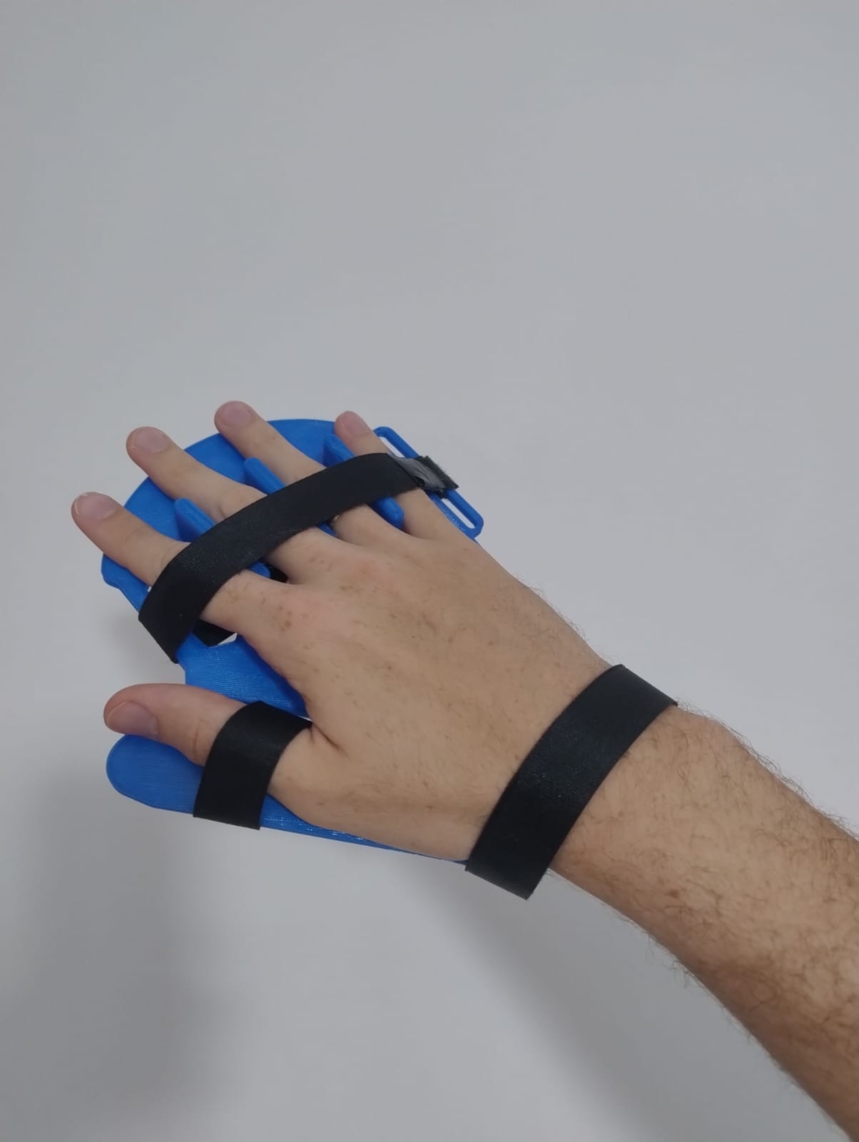 Hand Splint / Finger Separator — miniatura 3
