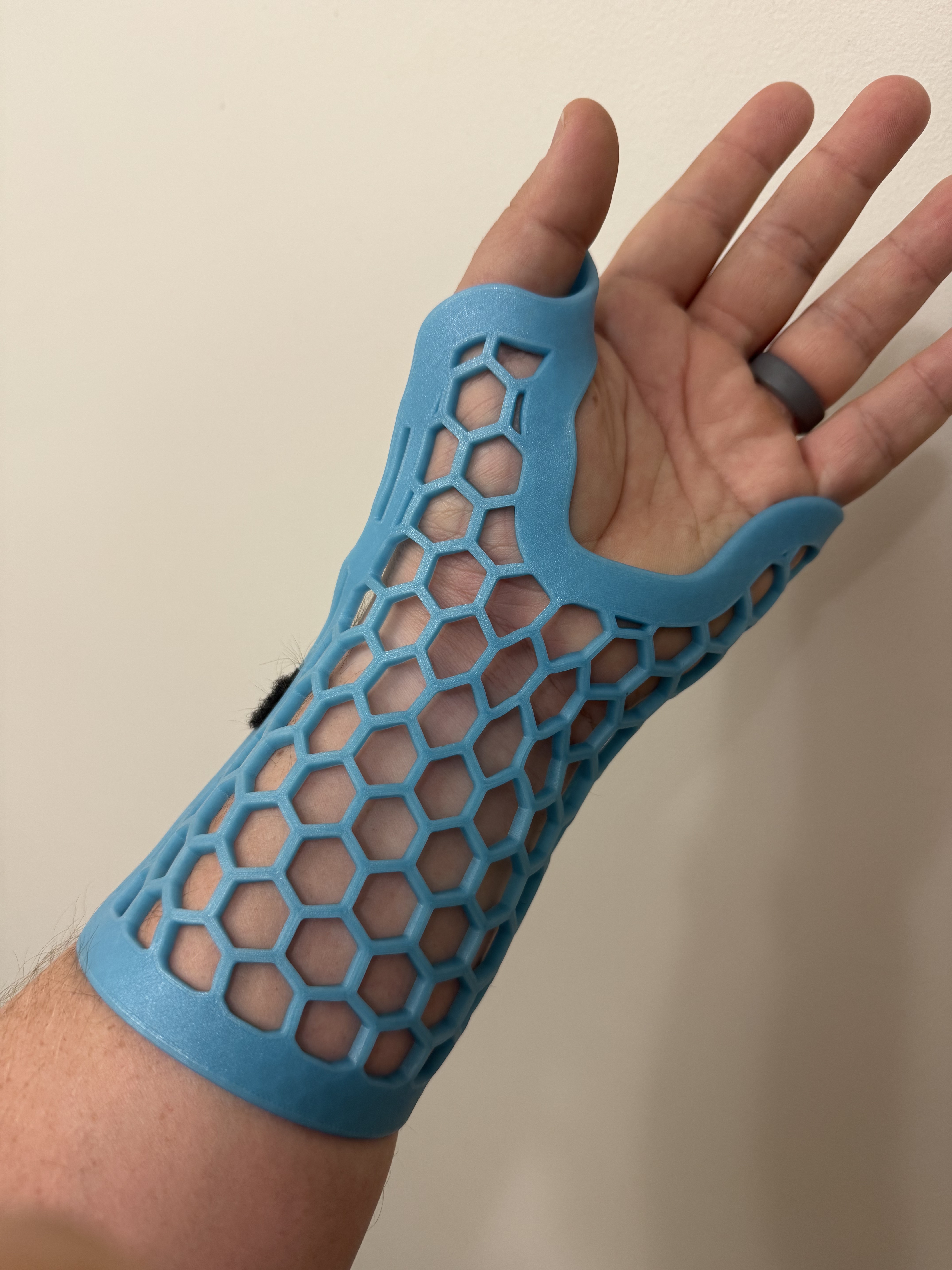 Wrist Splint (Custom Moldable)
