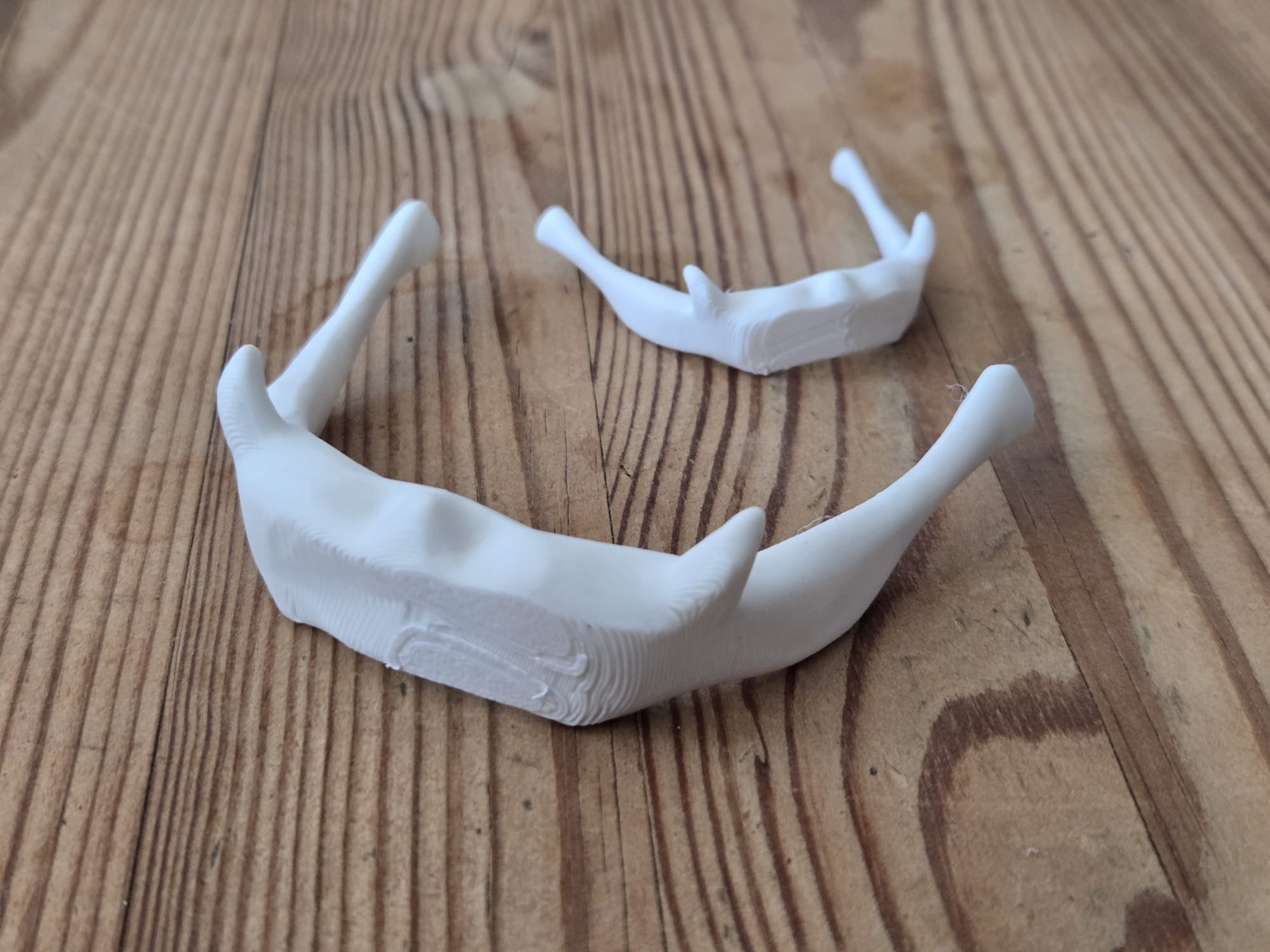 Hyoid Bone