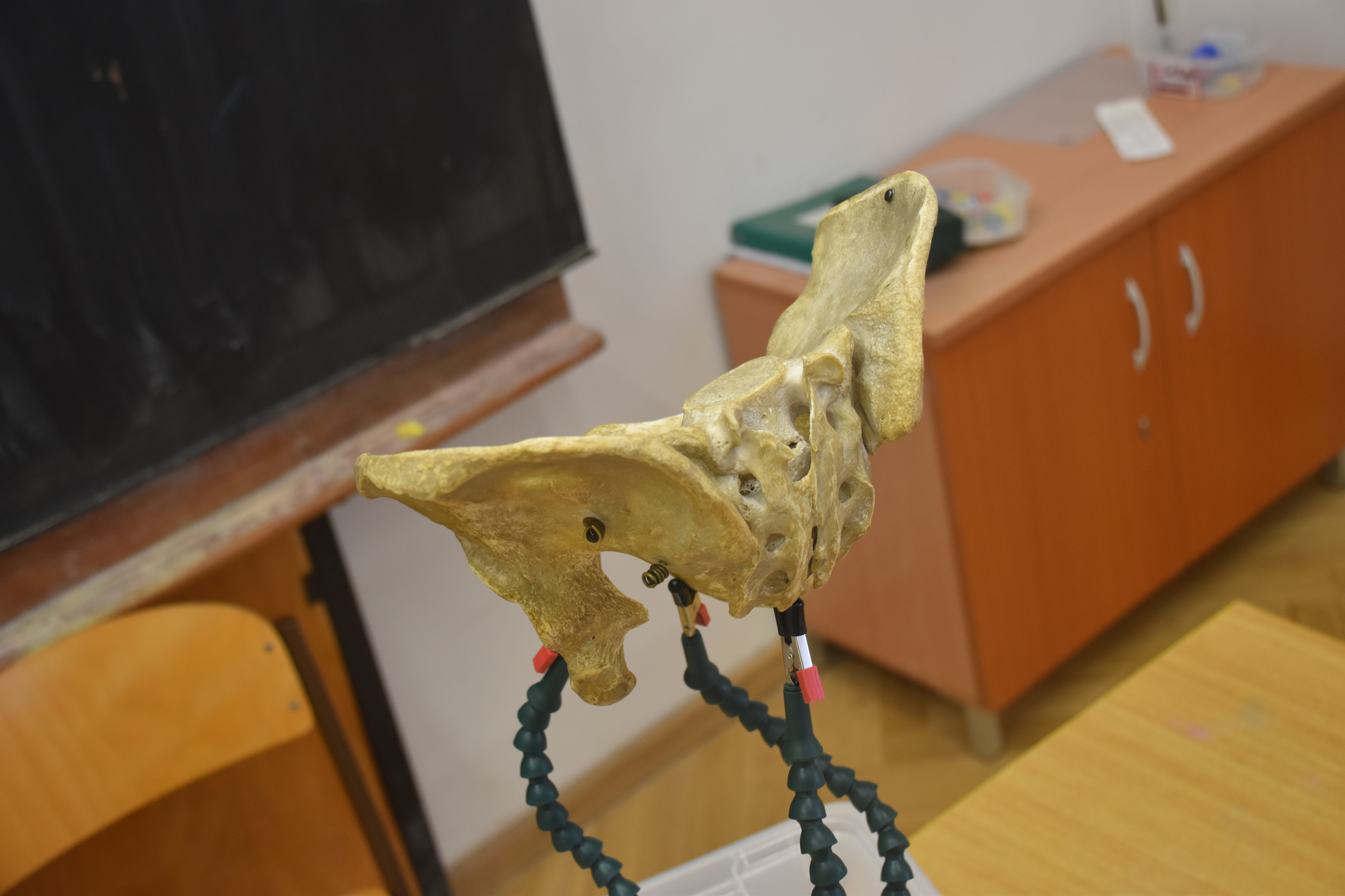 Pelvis Scan - Pelvis (M) — thumbnail 4