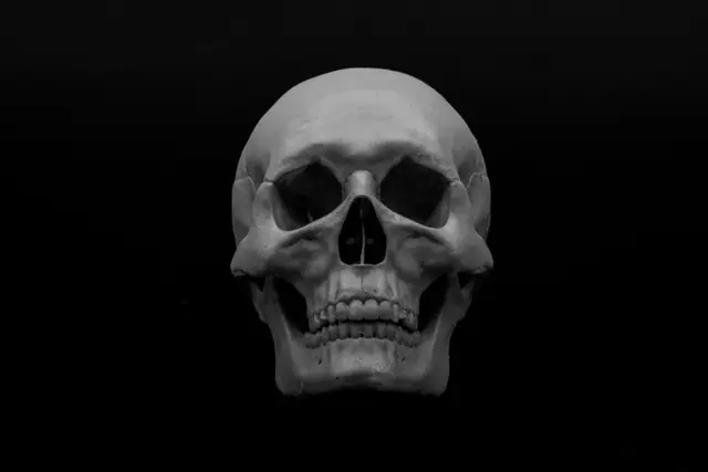 Human Skull (Pre Supported)