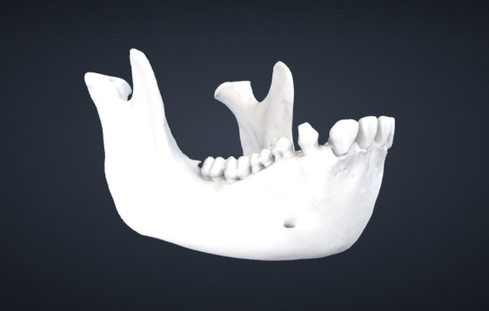 Female Gorilla Mandible