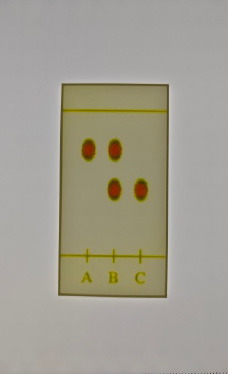 Aspirin TLC Plate – Lithophane Teaching Aid