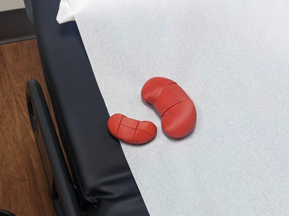 Kidney Twisty Puzzle