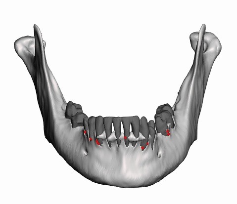 human mandible with teeth