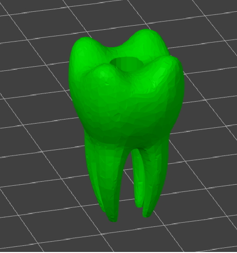 Molar dental bead