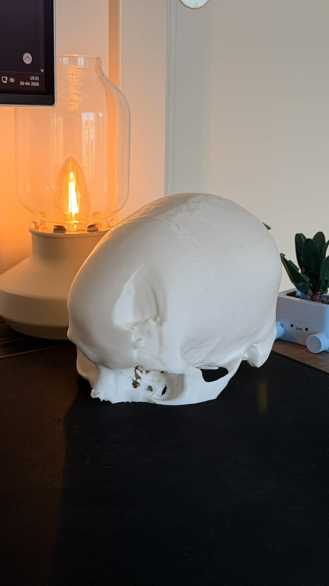 Real Segmented Human Skull