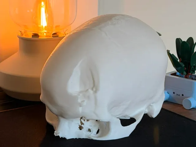Real Segmented Human Skull