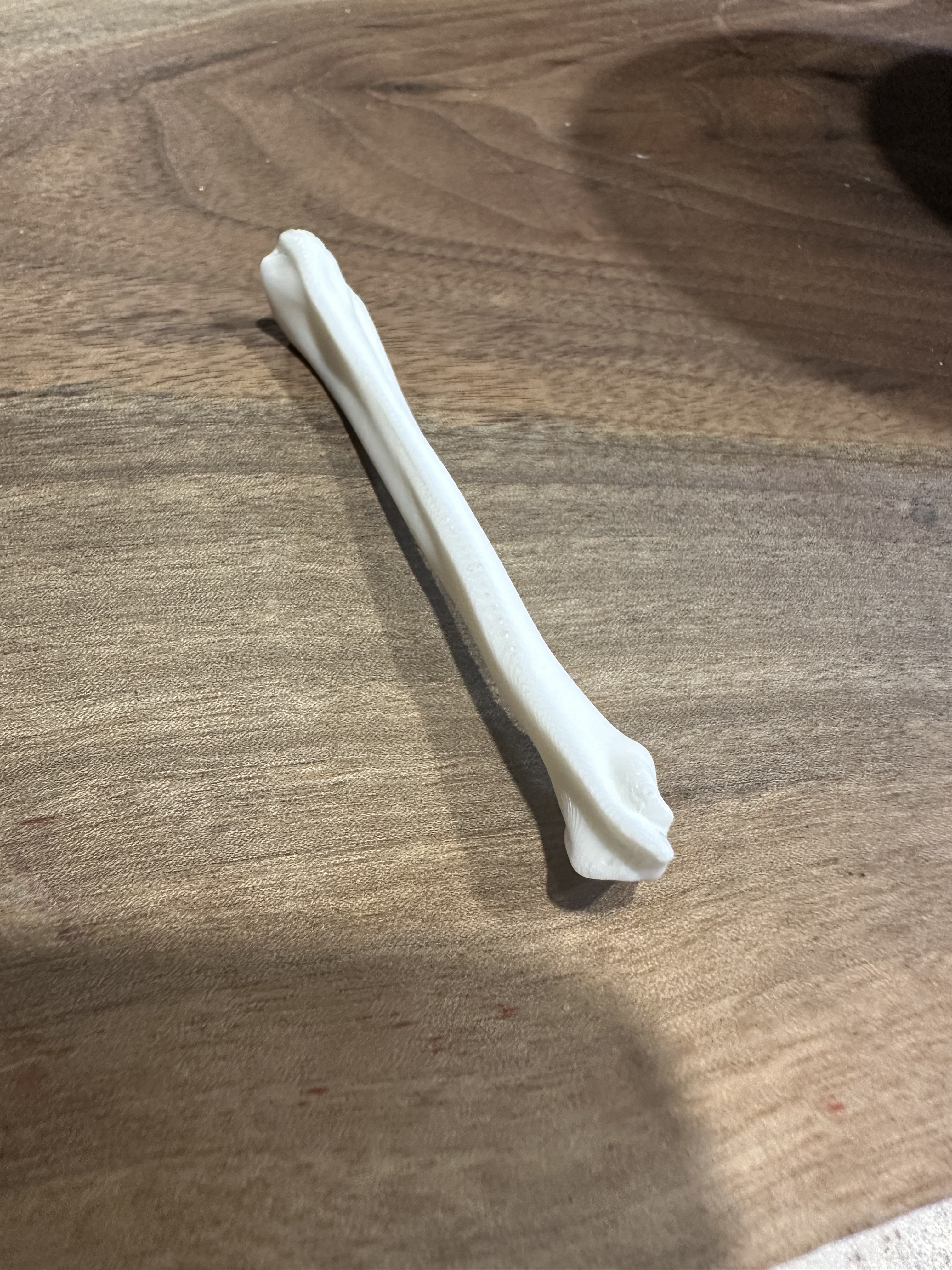 Metatarsal Bone