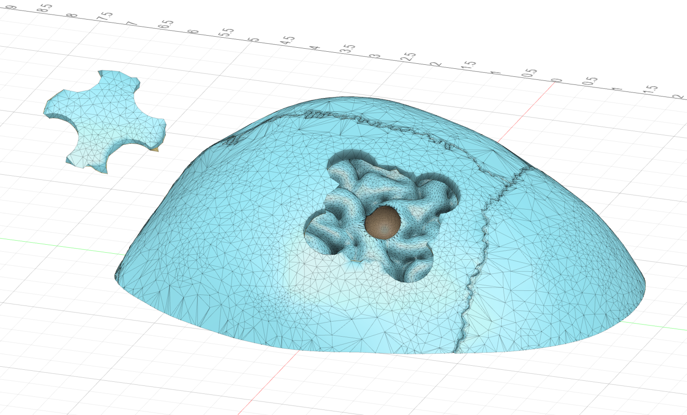 Motor Tumor Surgery Model
