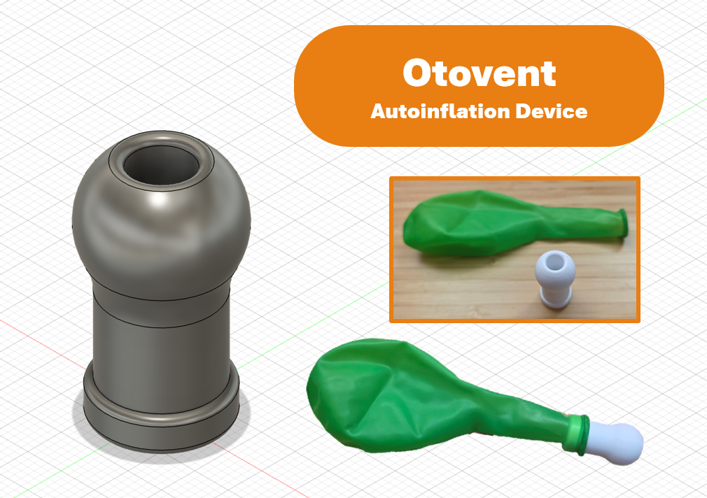 Otovent - Adult Autoinflation Device - Clinically Effective Treatment for Glue Ear (FUSION 360 Sources included)
