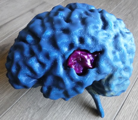 MRI Brain 3D model