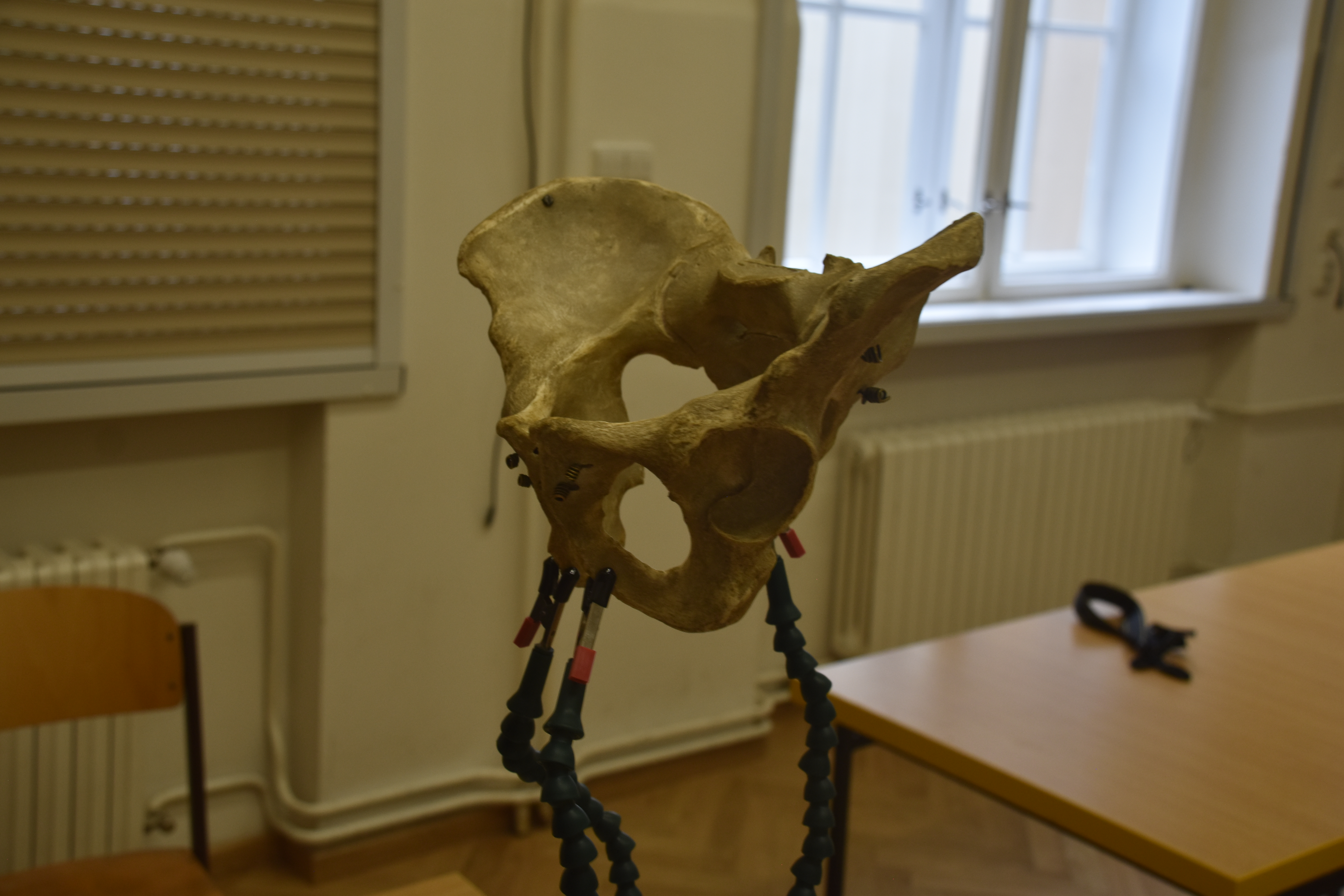 Pelvis Scan - Pelvis (M) — thumbnail 3
